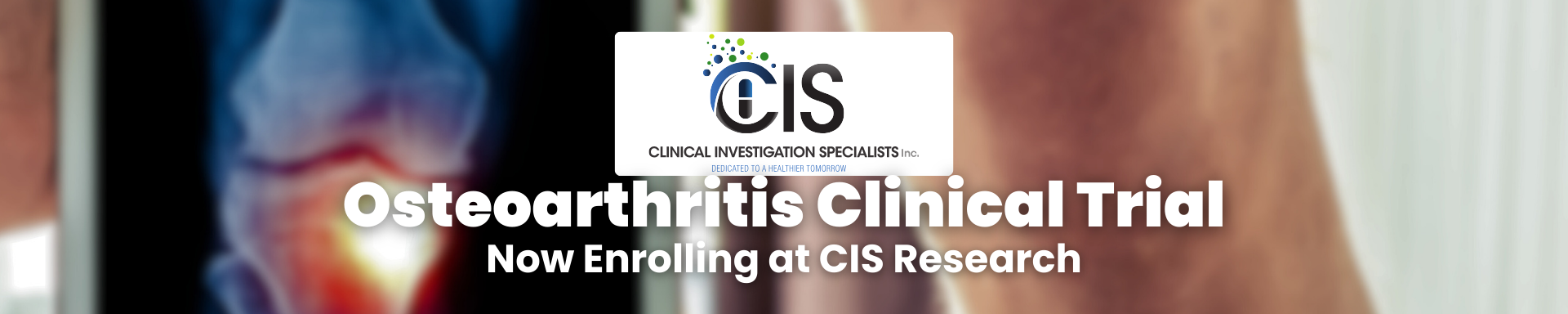 osteoarthritis clinical trial