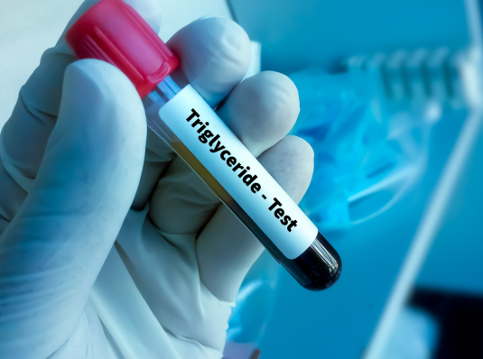 blood tube measuring triglycerides